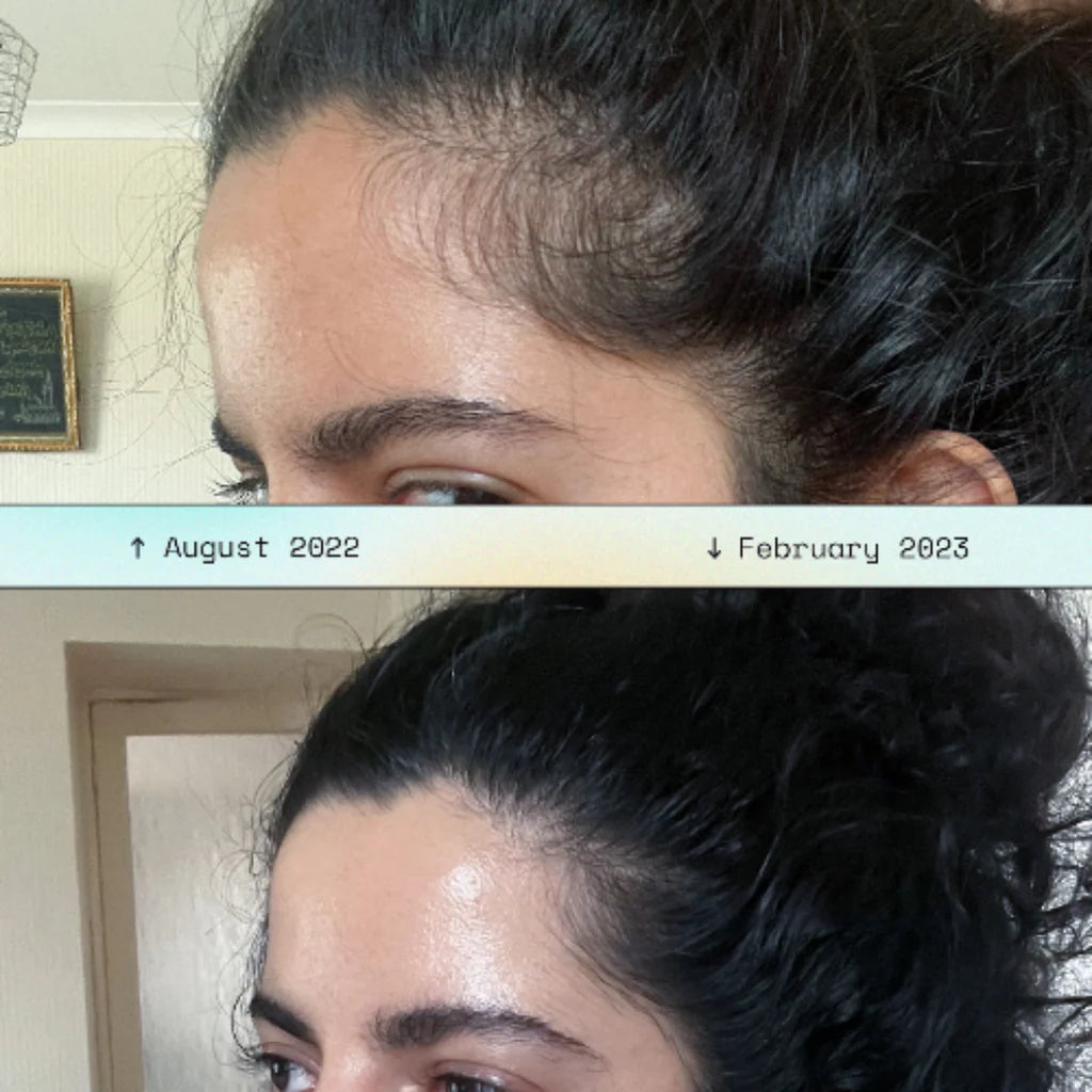 Cryovia Electric Scalp Head Massager